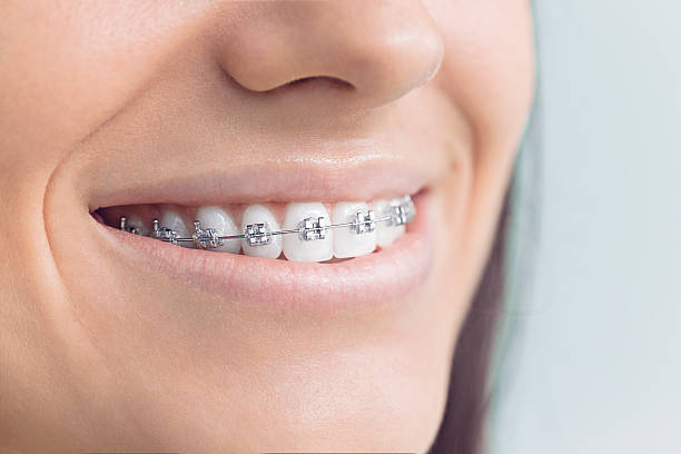 Best Full Mouth Reconstruction  in Spearfish, SD