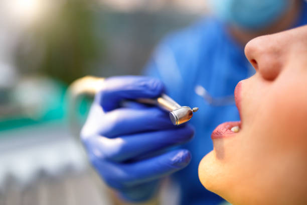 Best Teeth Whitening  in Spearfish, SD